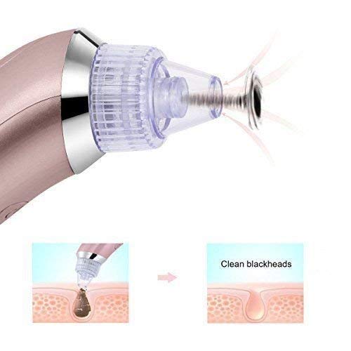 Derma Suction Blackhead Remover Acne And Pore Cleanser