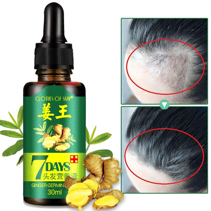 Ginger Hair Growth Serum Stop Hair Loss