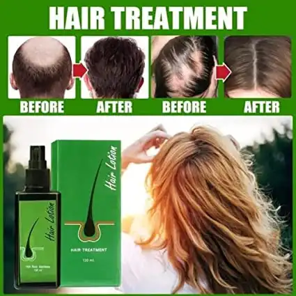 Hair Lotion Hair Treatment, Hair Root Nutrients, Hair Size 1...